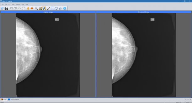 Sante FFT Imaging sc.png