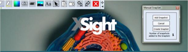 Recordex USA XSight HD sc.jpg