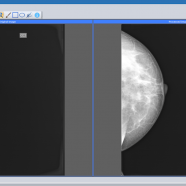 Sante FFT Imaging sc.png